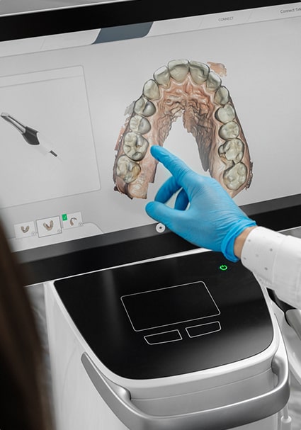 口腔内スキャナー「iTero Lumina」