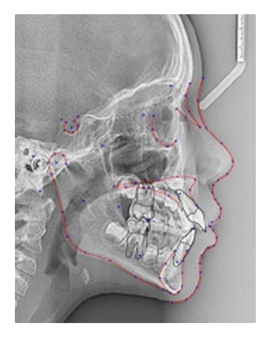 歯科用CT・セファログラム
